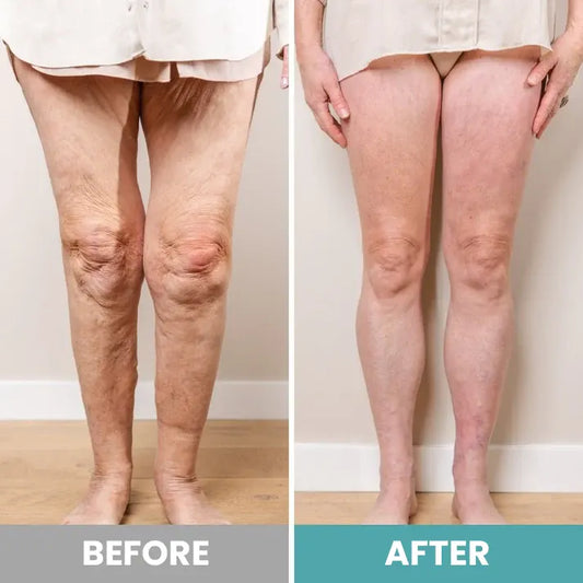 RelaxOn™ - Foot massager