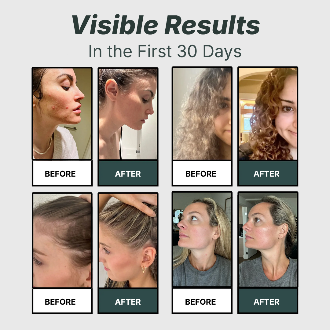 DermaPure®