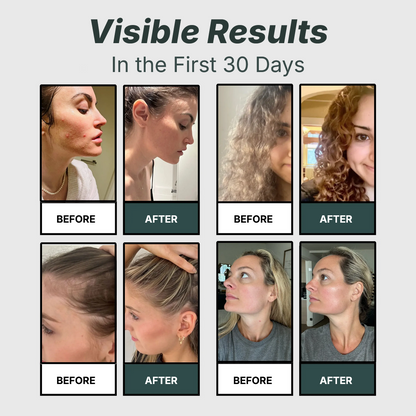 DermaPure®